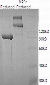 Recombinant Human Diamine Oxidase/DAO/AOC1 (C-6His)